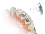 BiteTurbo - protège-dents